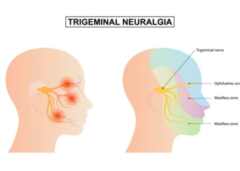 Entenda O Que E Neuralgia Do Trigemeo Que Faz Brasileira Gazeta Mercantil