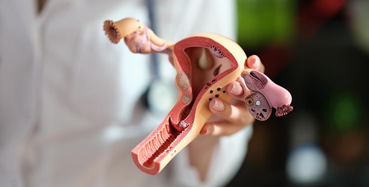 Saco De Douglas - Gazeta Mercantil