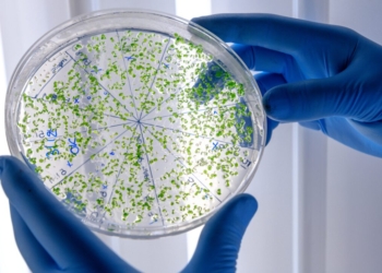 Cientistas descobrem ponto fraco de bactéria achada em produtos Ypê 2 GAZETA MERCANTIL Cientistas Descobrem Ponto Fraco De Bactéria Achada Em Produtos Ypê - Gazeta Mercantil - Saúde