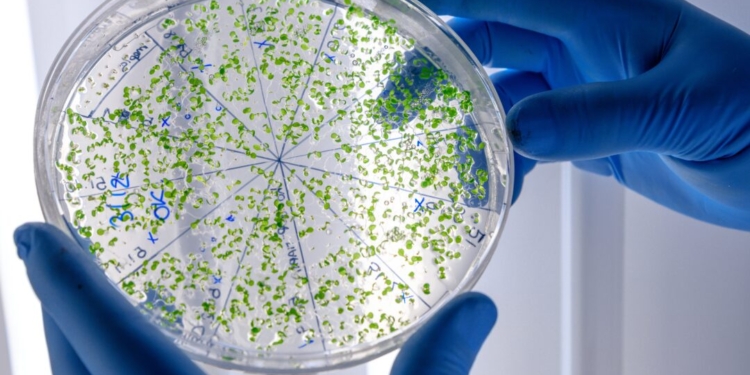 Cientistas descobrem ponto fraco de bactéria achada em produtos Ypê 1 GAZETA MERCANTIL Cientistas Descobrem Ponto Fraco De Bactéria Achada Em Produtos Ypê - Gazeta Mercantil - Saúde